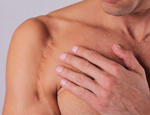 Supporting Healing After Surgery: An Integrative Approach to Tissue Repair